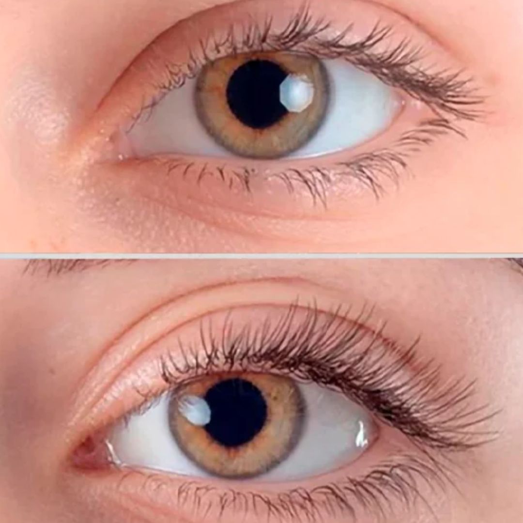 Conceptikal - Aumenting Lash thumbnail