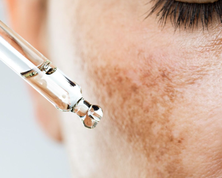 Tratamiento intensivo 3 pasos para manchas faciales