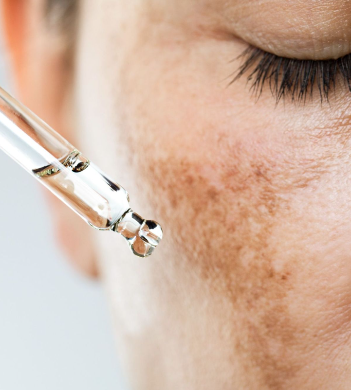 Tratamiento intensivo 3 pasos para manchas faciales