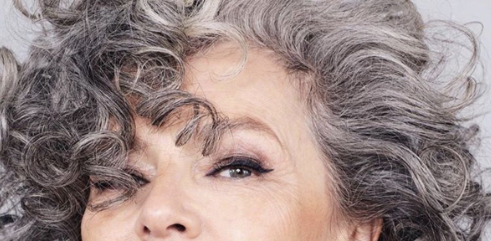 Canas y vitiligio, adios permanente