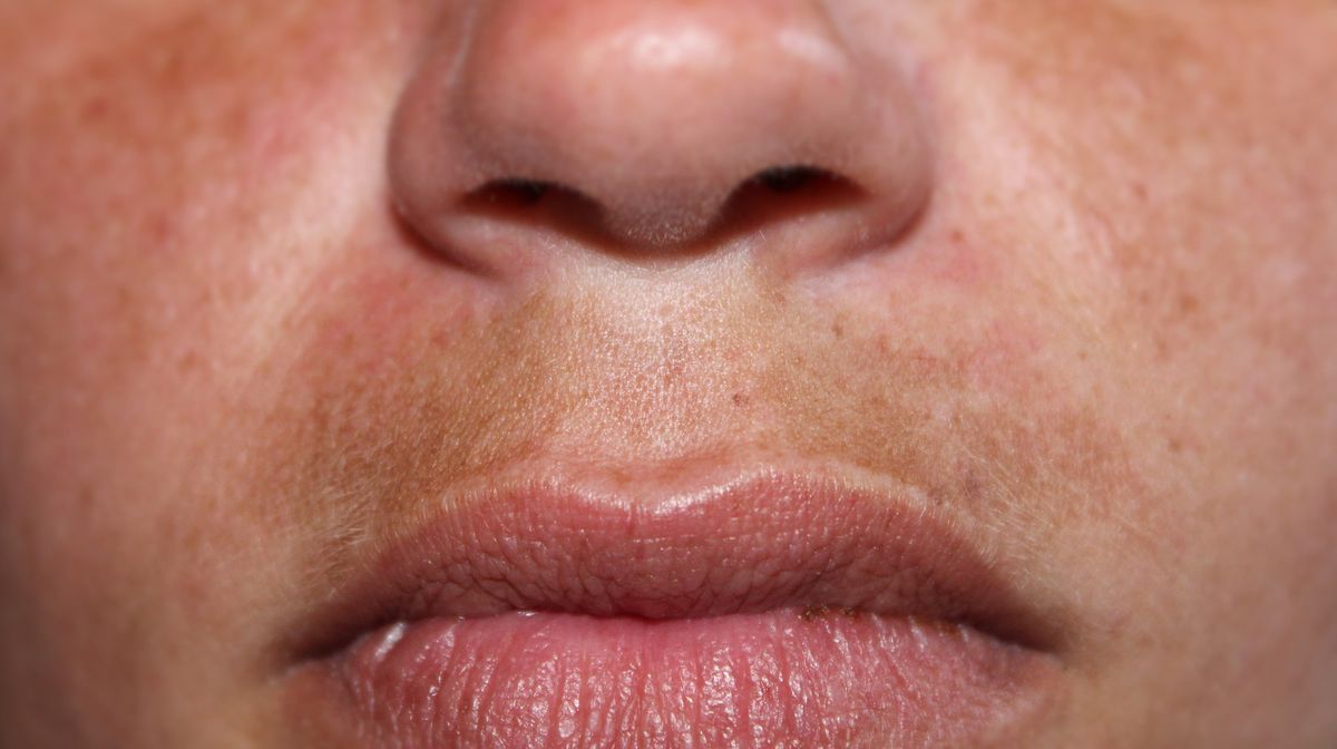 Combatir manchas en el bigote
