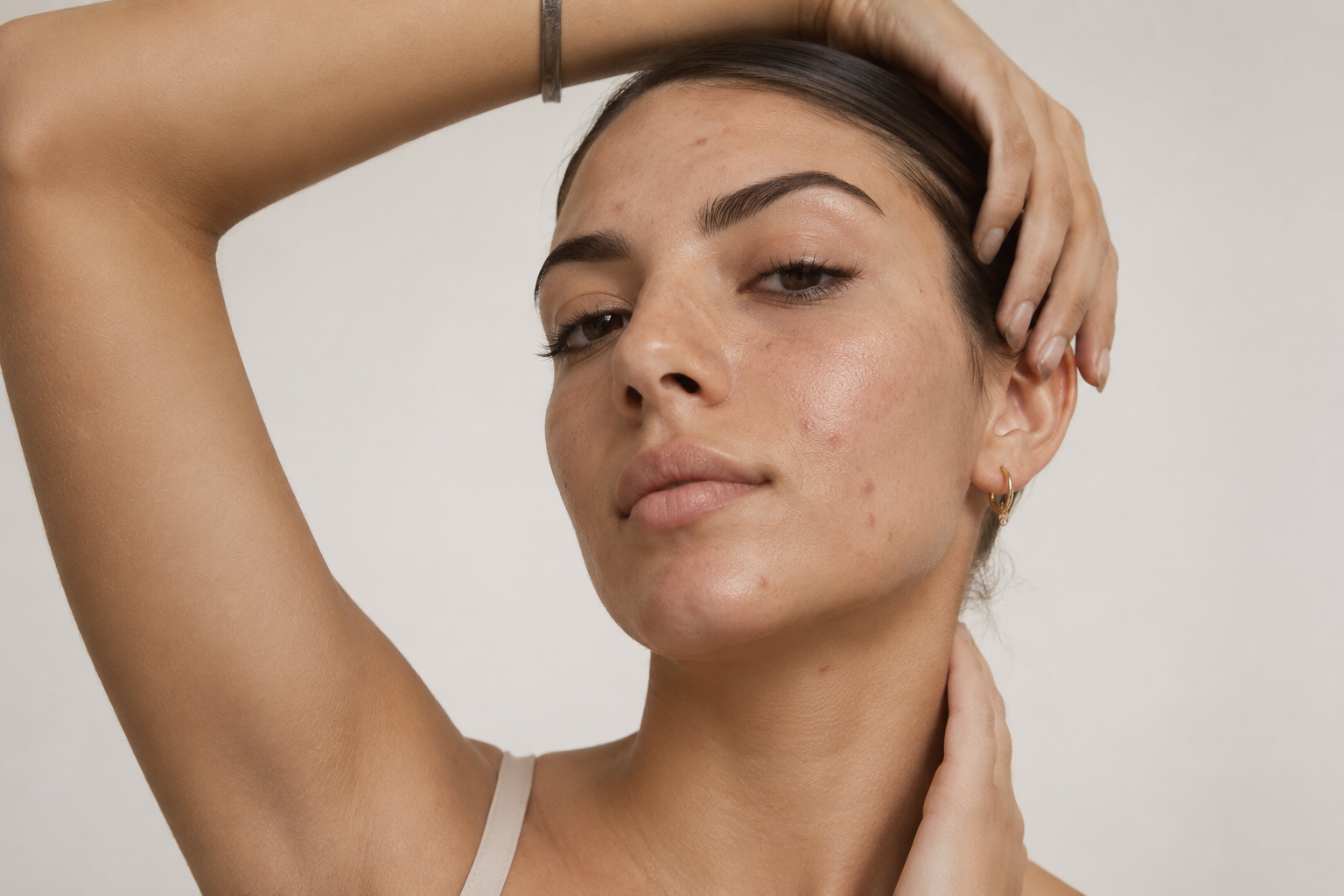 Cosmética facial antiacné