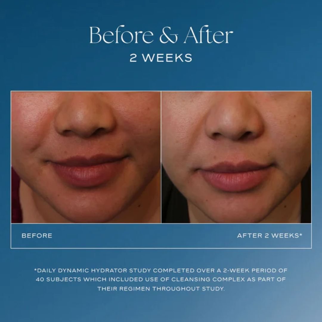 Daily Dynamic Hydrator - Cremas de iS Clinical thumbnail