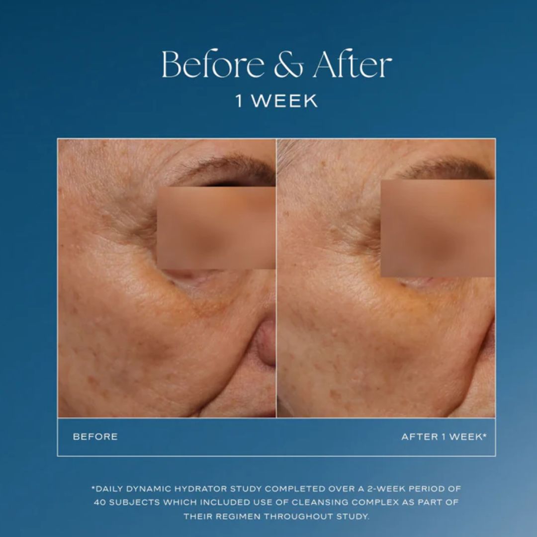 Daily Dynamic Hydrator - Cremas de iS Clinical thumbnail