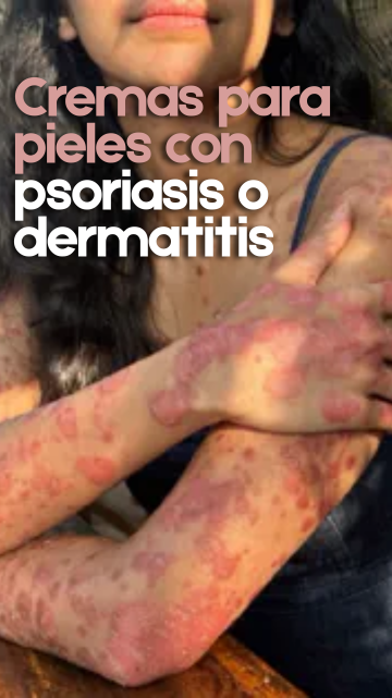 Cremas para pieles con psoriasis o dermatitis.