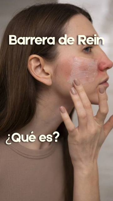 Que es la barrera de Rein