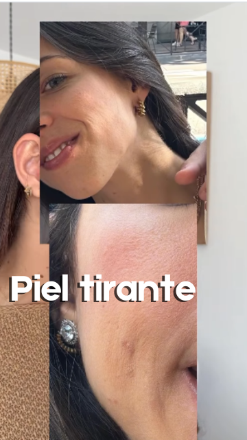 Piel seca y tirante, esthederm